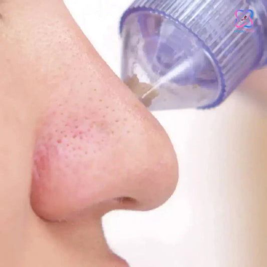 Loot Phoot™ 4 in 1 Derma Vacuum Suction Blackhead/Acne/Oil/Pore Cleaner Loot Phoot™