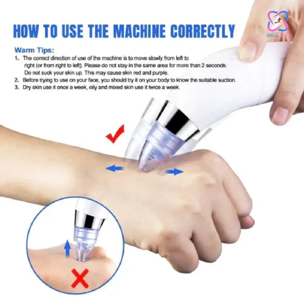 4 in 1 Derma Vacuum Suction Blackhead/Acne/Oil/Pore Cleaner